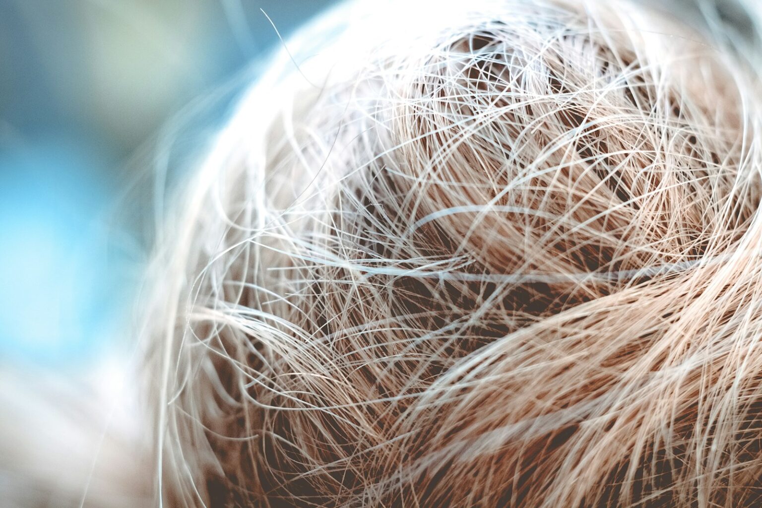 trapianto di capelli in turchia